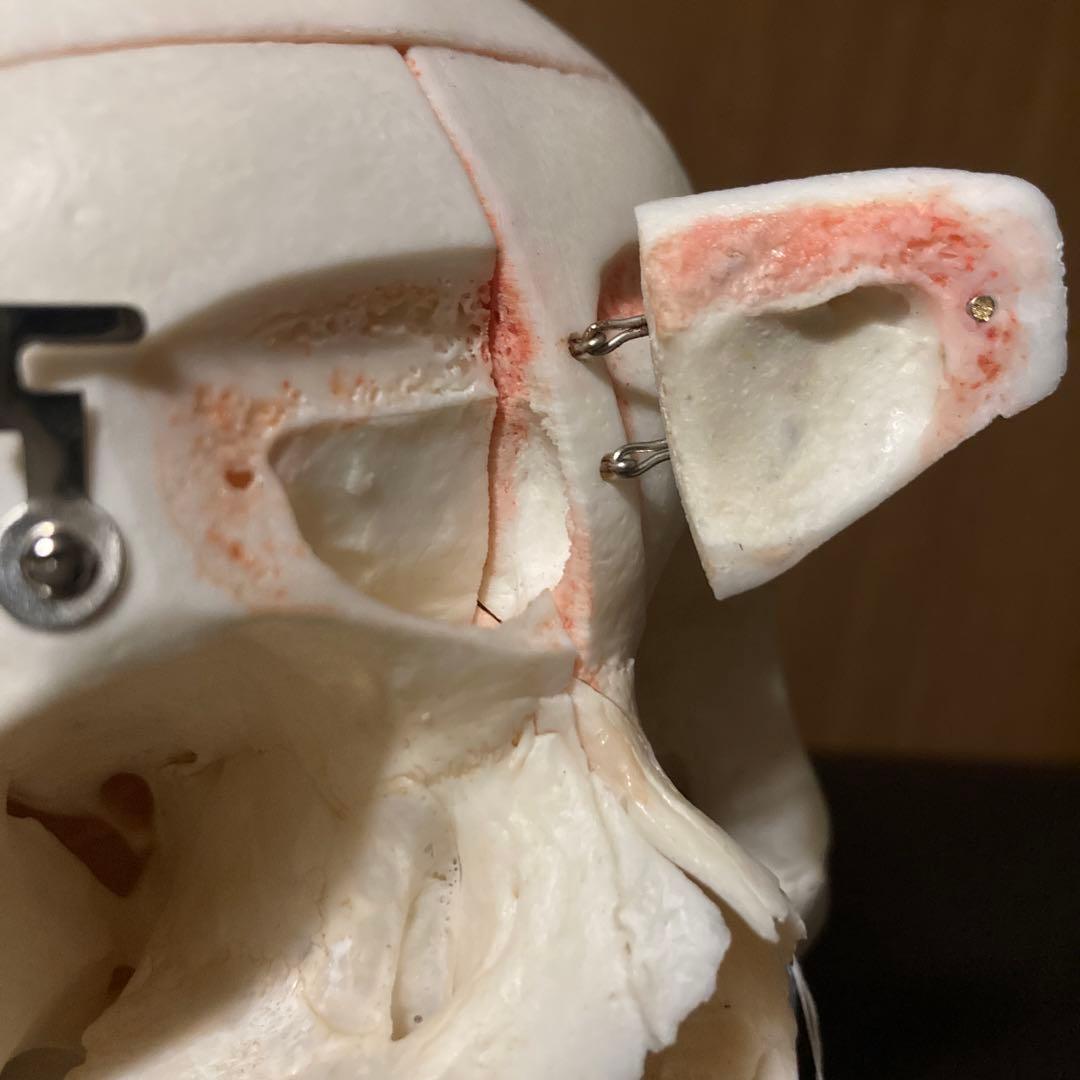 頭蓋骨　模型　解剖学