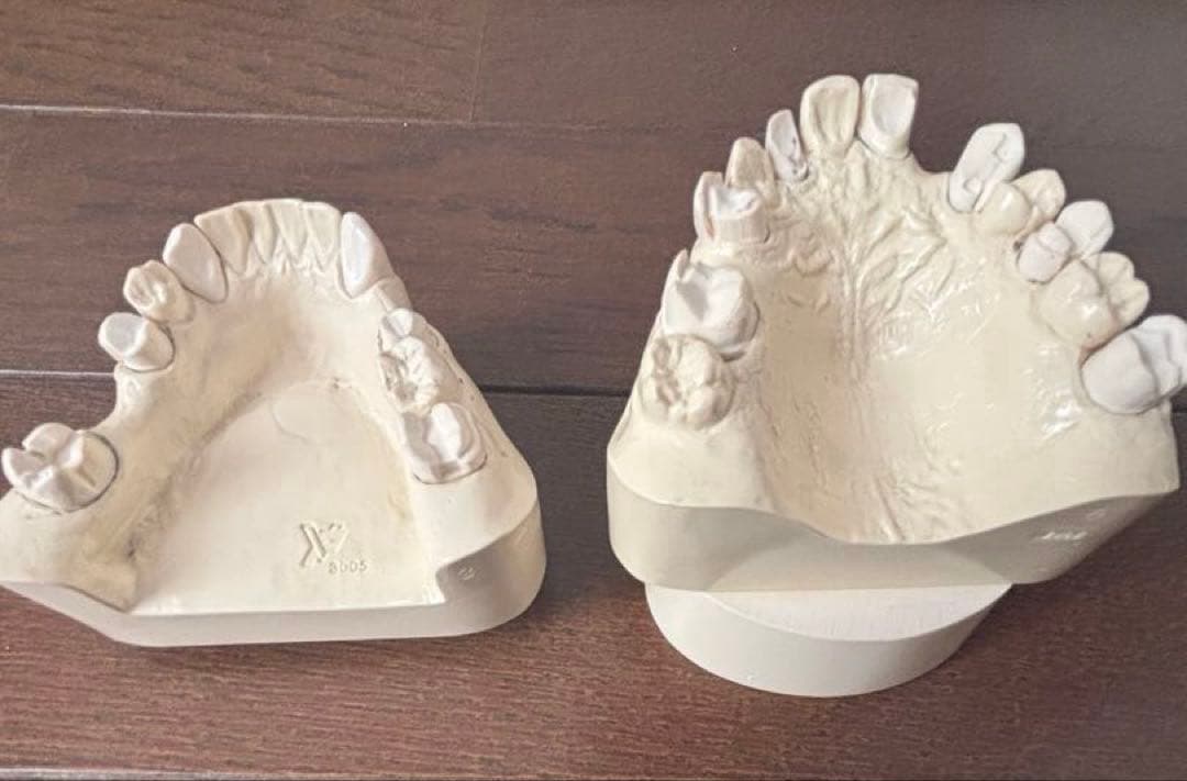 歯科　支台歯形成　練習模型　セット