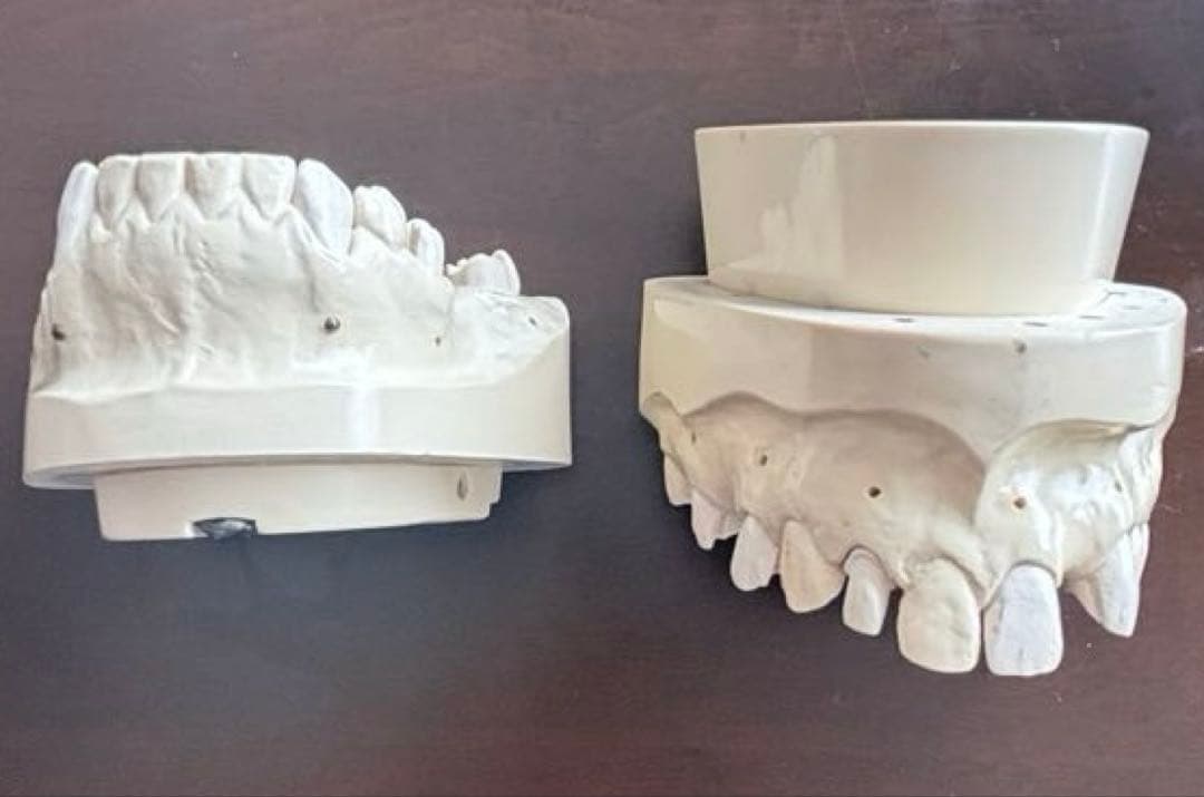 歯科　支台歯形成　練習模型　セット