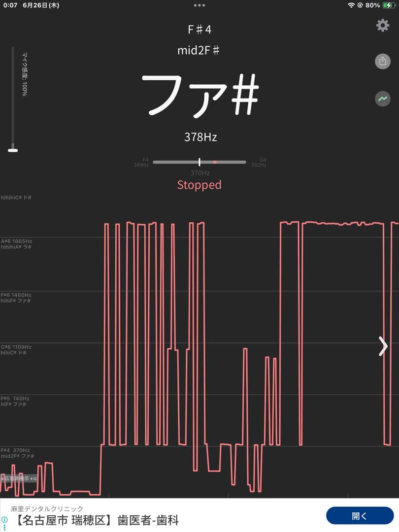 no50チベット産 シンギングボウル 新品 チベタンボウル 15cm AUM