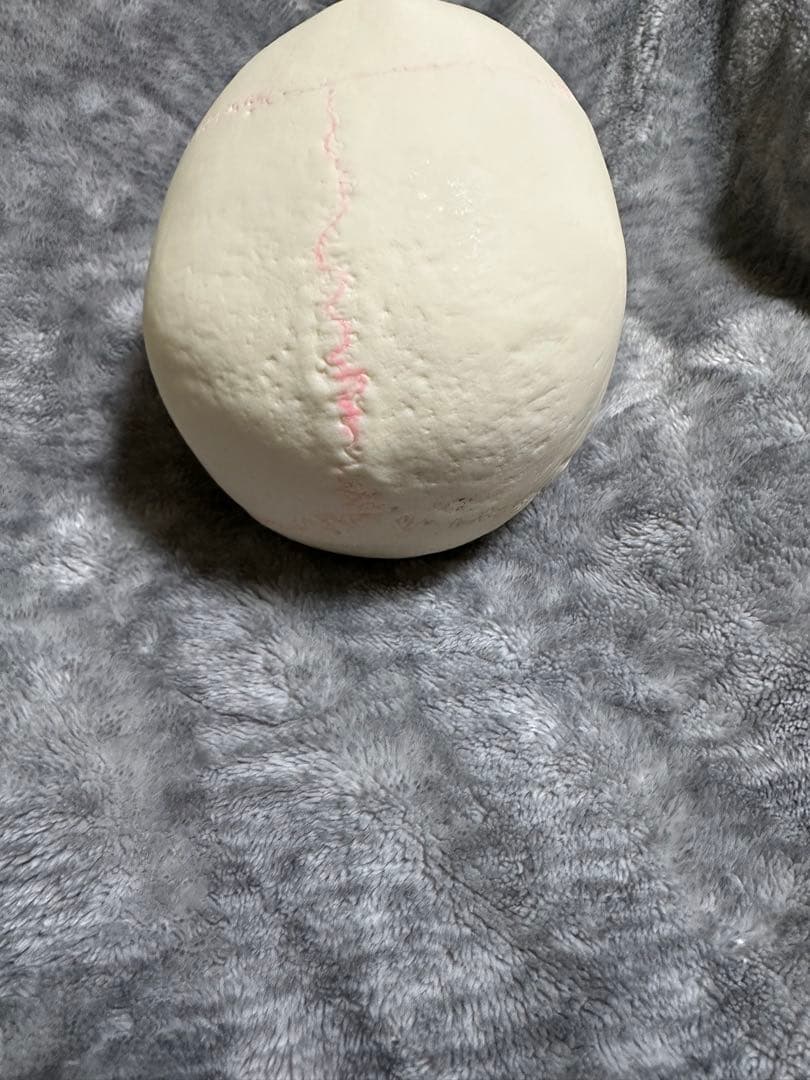 SOMSO 頭蓋骨模型 解剖模型 医学/歯科教材