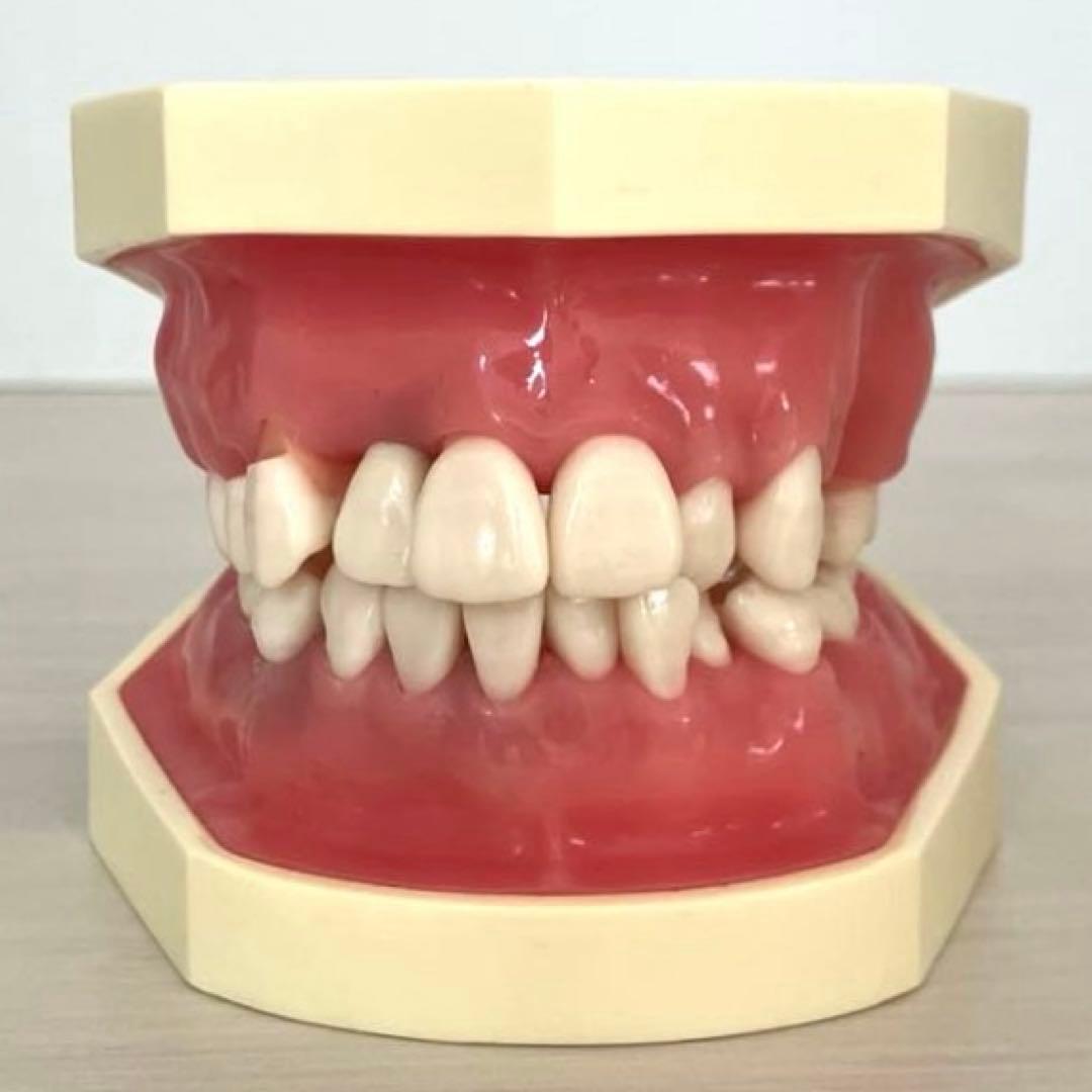 NISSIN ニッシン額模型　叢生顎模型