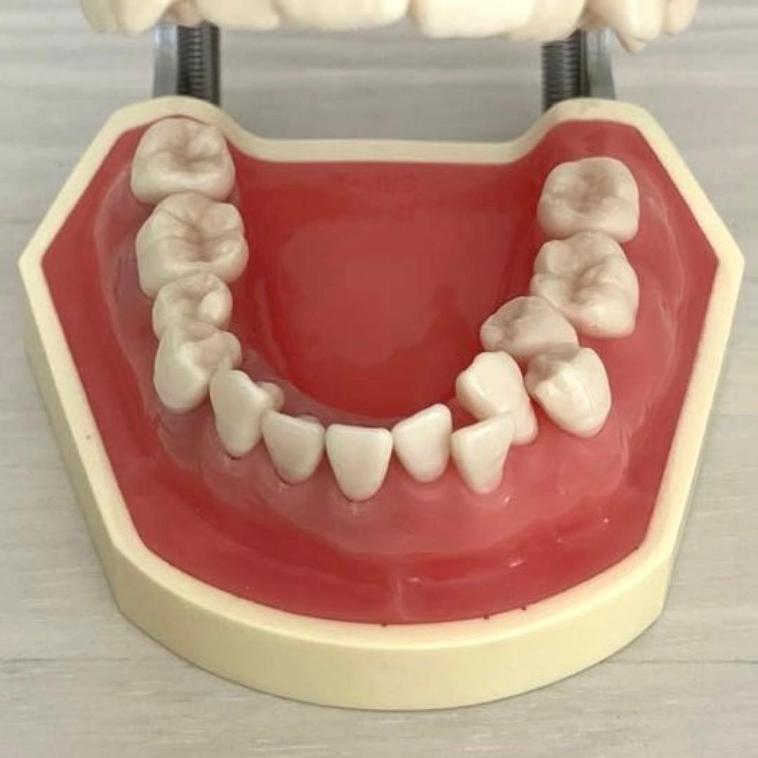 NISSIN ニッシン額模型　叢生顎模型