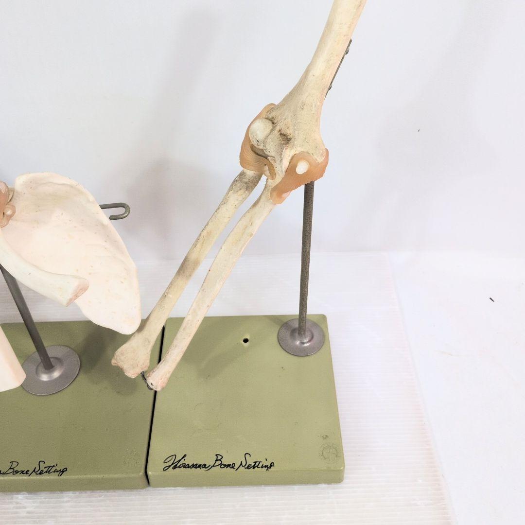 SOMSO 肩関節 膝関節 肘関節 椎間板 模型 ソムソ ドイツ製 人体模型