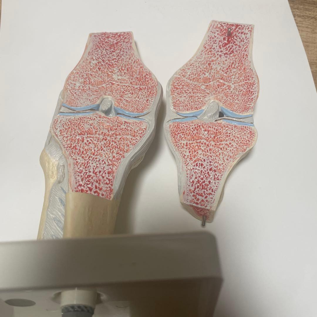 膝関節模型 3B 膝関節断面モデル
