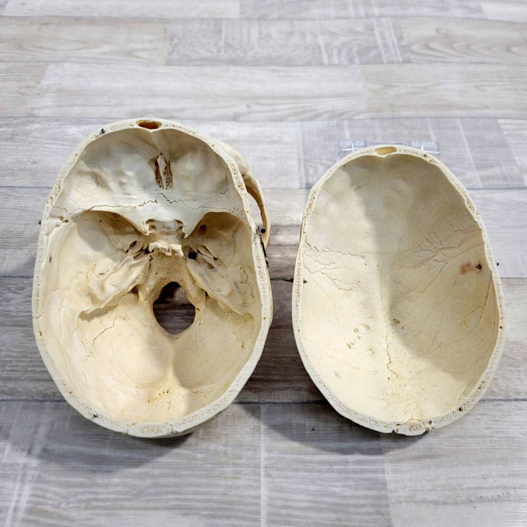 頭蓋骨 頭骨 骨格標本 人体模型 医療 医学 人類学 民俗学 アンティーク 呪物