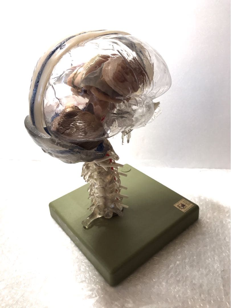 独SOMSO社 (ソムソ社) BS25/T透明な１５分解脳模型♡ 　脳解剖模型