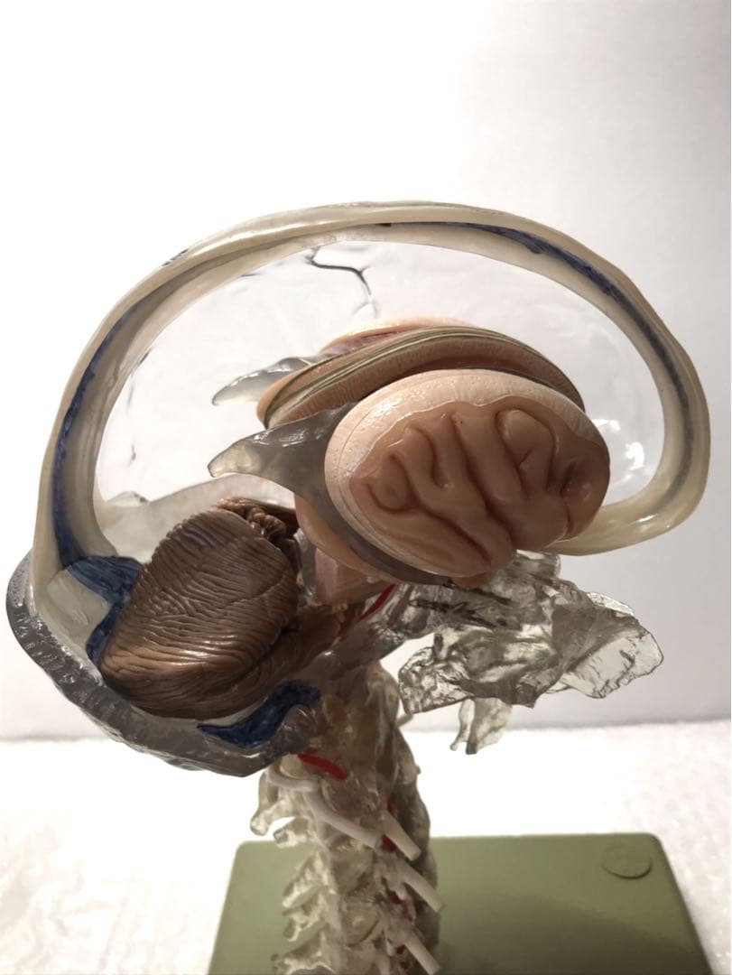 独SOMSO社 (ソムソ社) BS25/T透明な１５分解脳模型♡ 　脳解剖模型